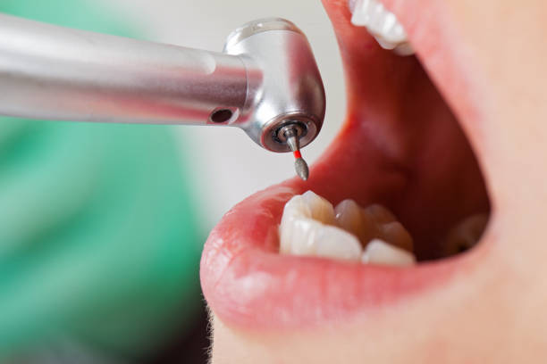 Best Emergency Wisdom Tooth Extraction in Ho Ho Kus, NJ